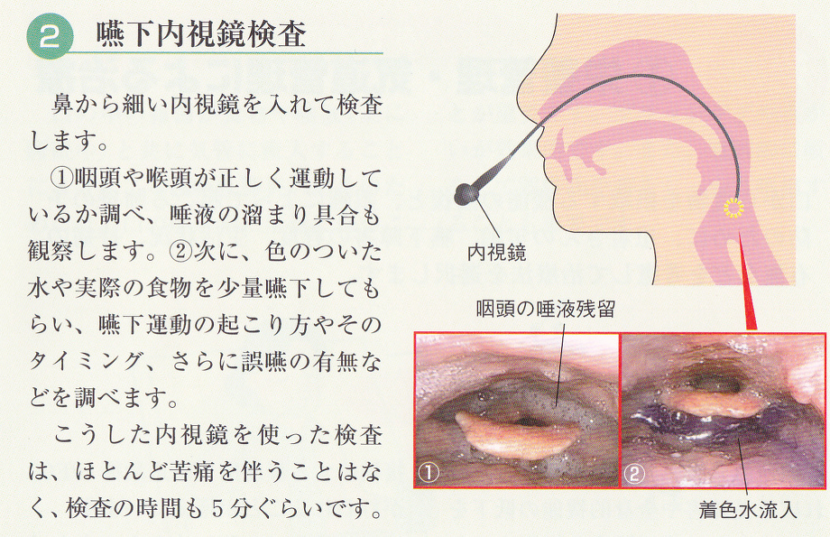 誤嚥性肺炎の予防・リハビリ 藤谷順子先生 | 川村内科診療所様